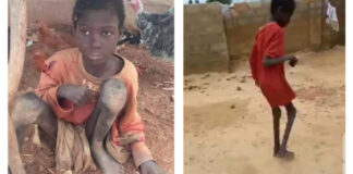 Boy Forced To Live With Animals In A Stall Rescued